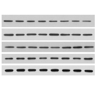 蛋白質免疫印迹(Western Blot, WB )